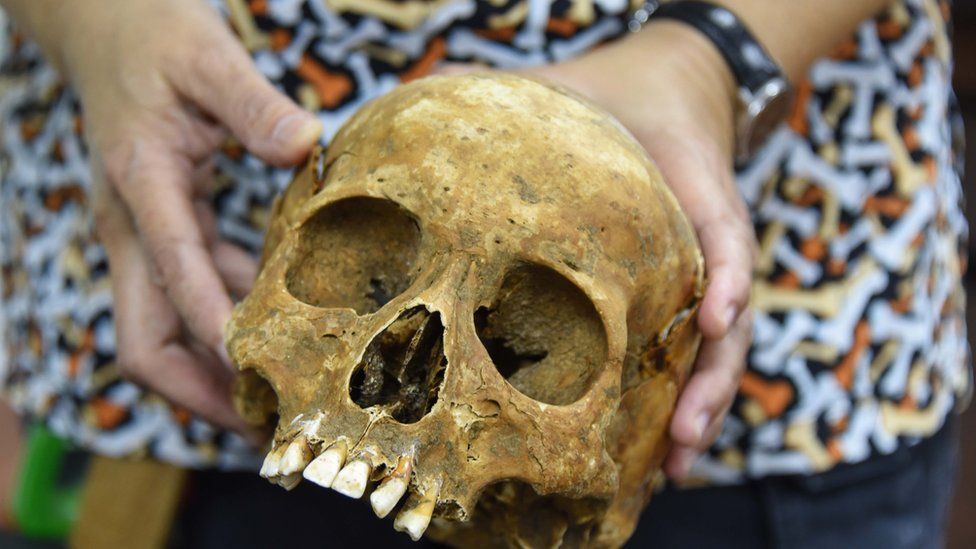 Filipino forensic pathologist Raquel Fortun holds skull of exhumed Duterte drug war victim