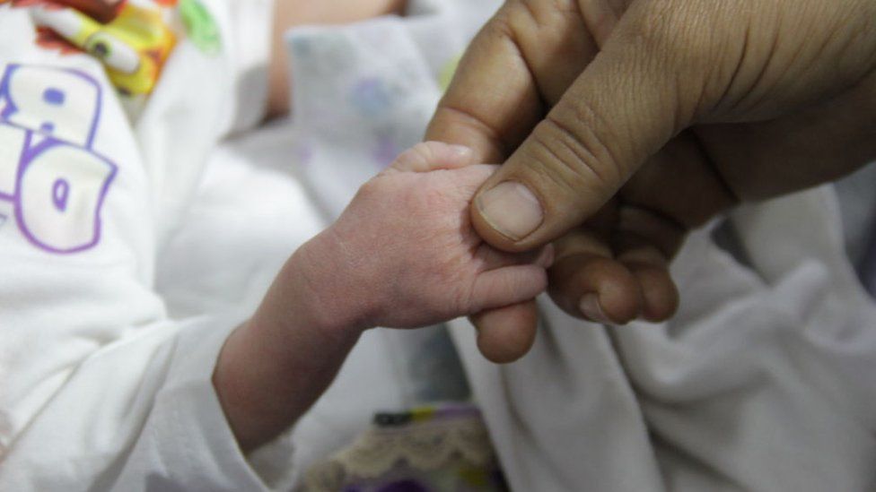 man holds hand of baby hospitalised for malnutrition at Kamal Adwan hospital in Gaza